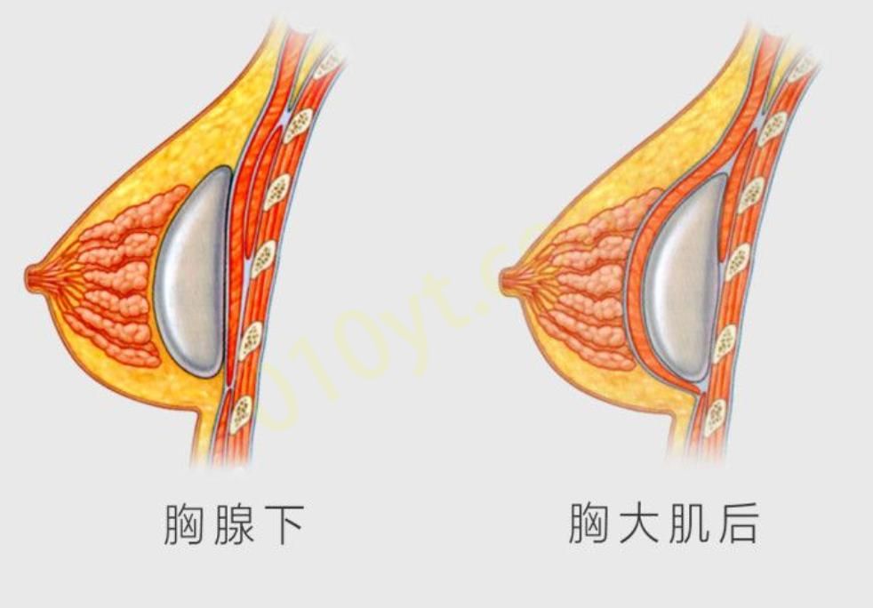 微信截图_20230809222124.png