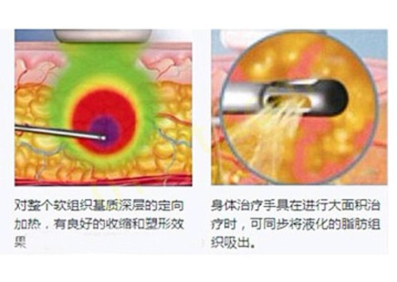 微信截图_20230810010335.png