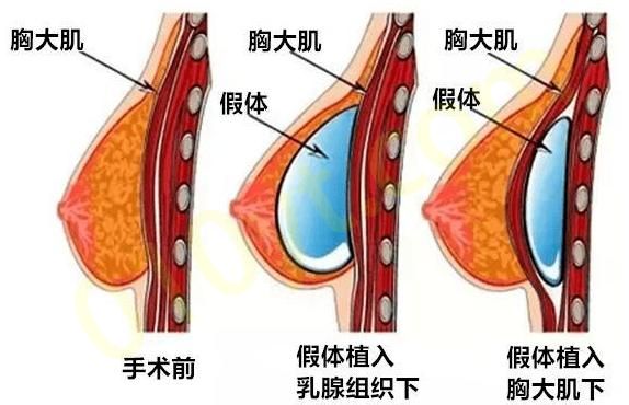 QQ浏览器截图20210910101420.png